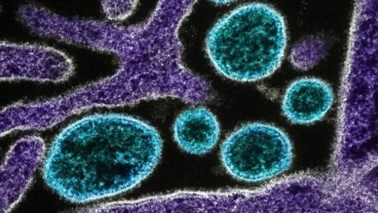 Gana'da M çiçeği virüsü yayılmaya devam ediyor - Son Dakika Haberleri
